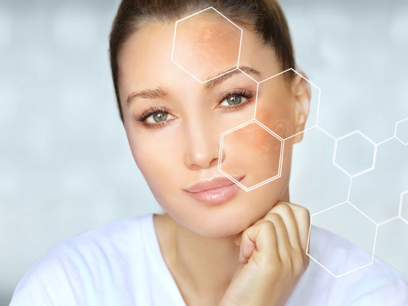 Najboljše naravne sestavine za boj proti pigmentaciji