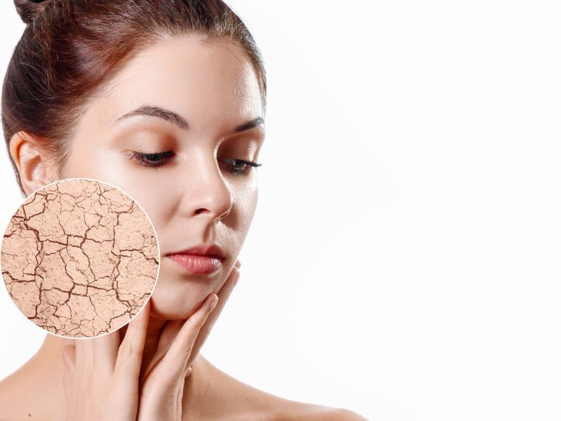 Transformacija suhe kože v hladnejših dneh: Kako izbrati pravo hranilno in hidratantno kremo?